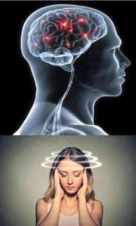 cogniclear-supplement-brain